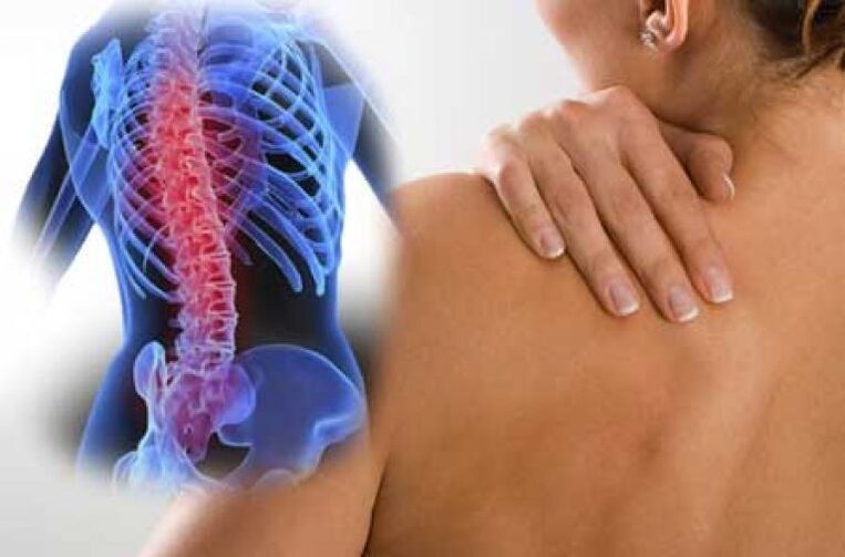 Dolor de espalda durante la exacerbación de la osteocondrosis torácica