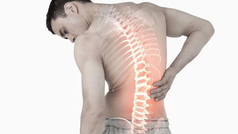 Causas de dolor lumbar