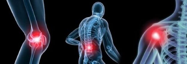 Tipos de dolor en la artritis