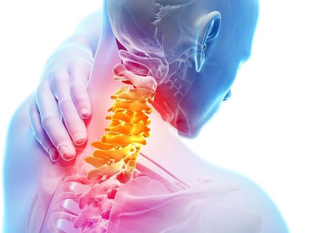 Síntomas y etapas de desarrollo de la osteocondrosis cervical
