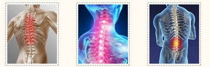 Enfermedad osteocondral